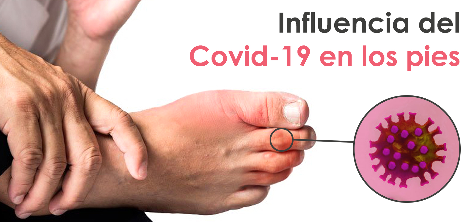 Influencia del Covid-19 en los pies