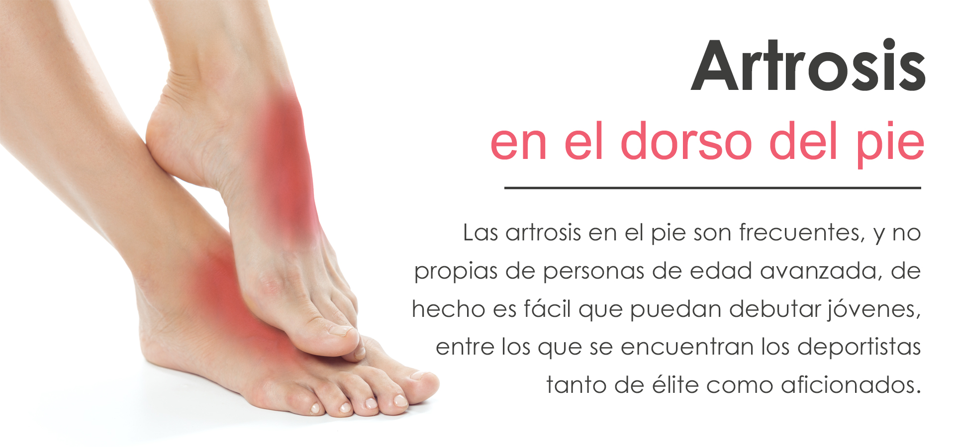 Artrosis en el dorso del pie