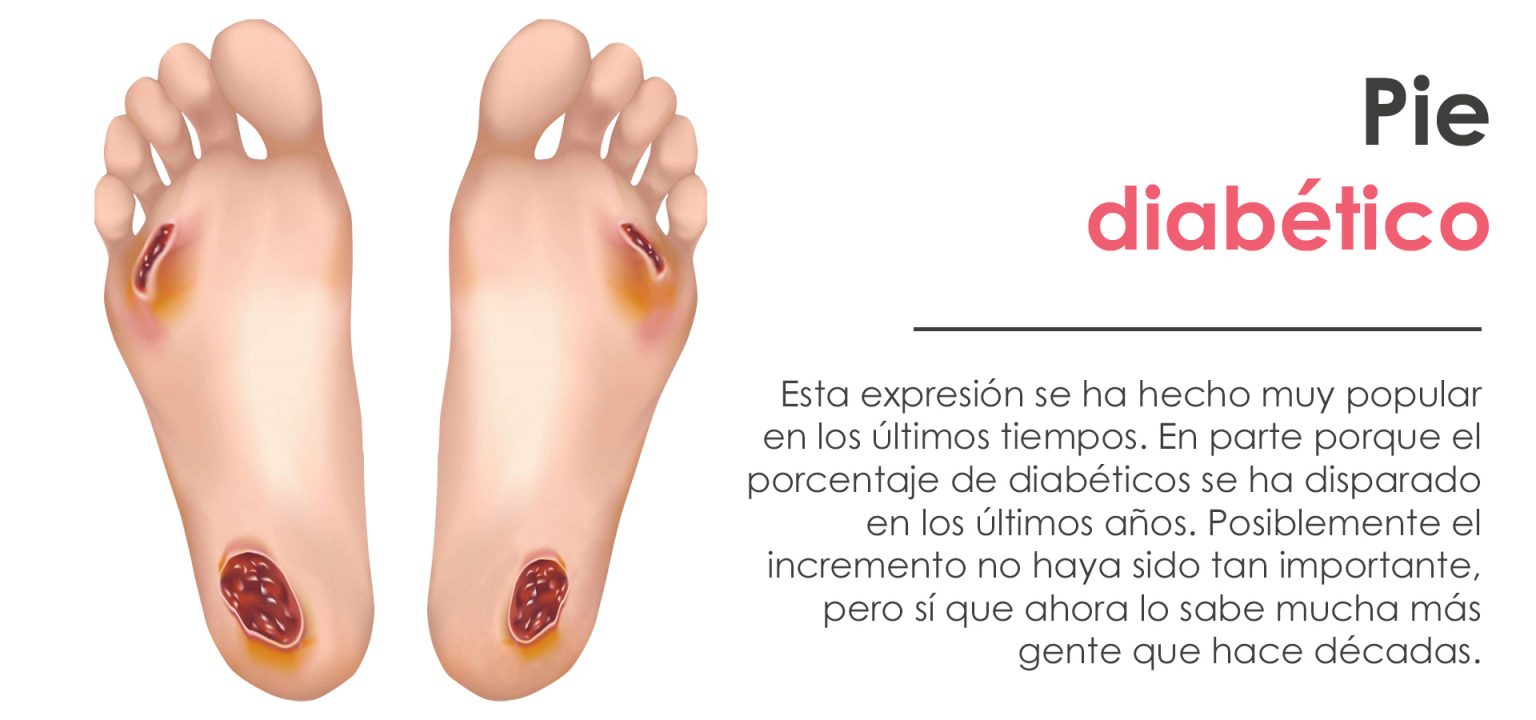 Pie diabético