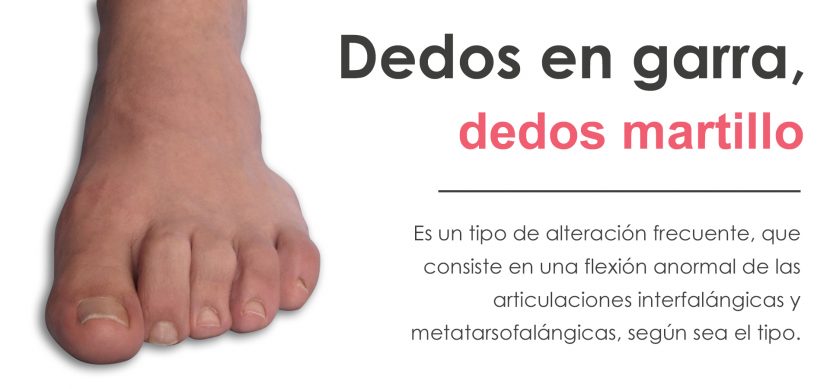 dedos en garra